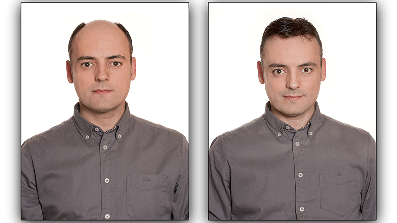 A poor choice of toupee looks unnatural.